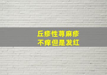 丘疹性荨麻疹 不痒但是发红